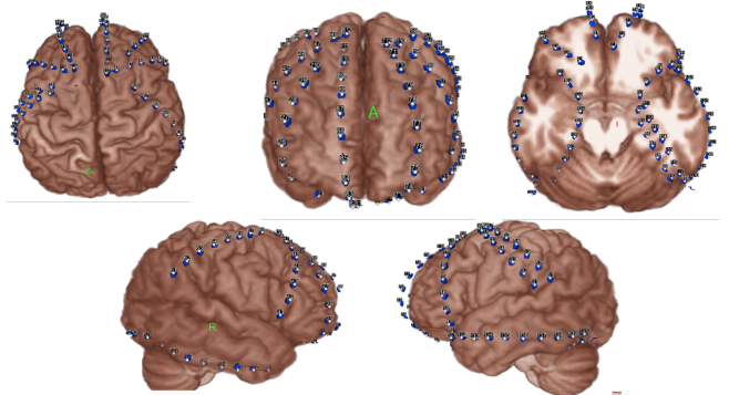 volume rendering of the cortical surface